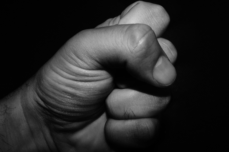 Életveszélyes sérülést okozott egy ütéssel Esztergomban