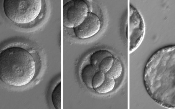 Először iktattak ki betegséget okozó DNS-t humán embrióból